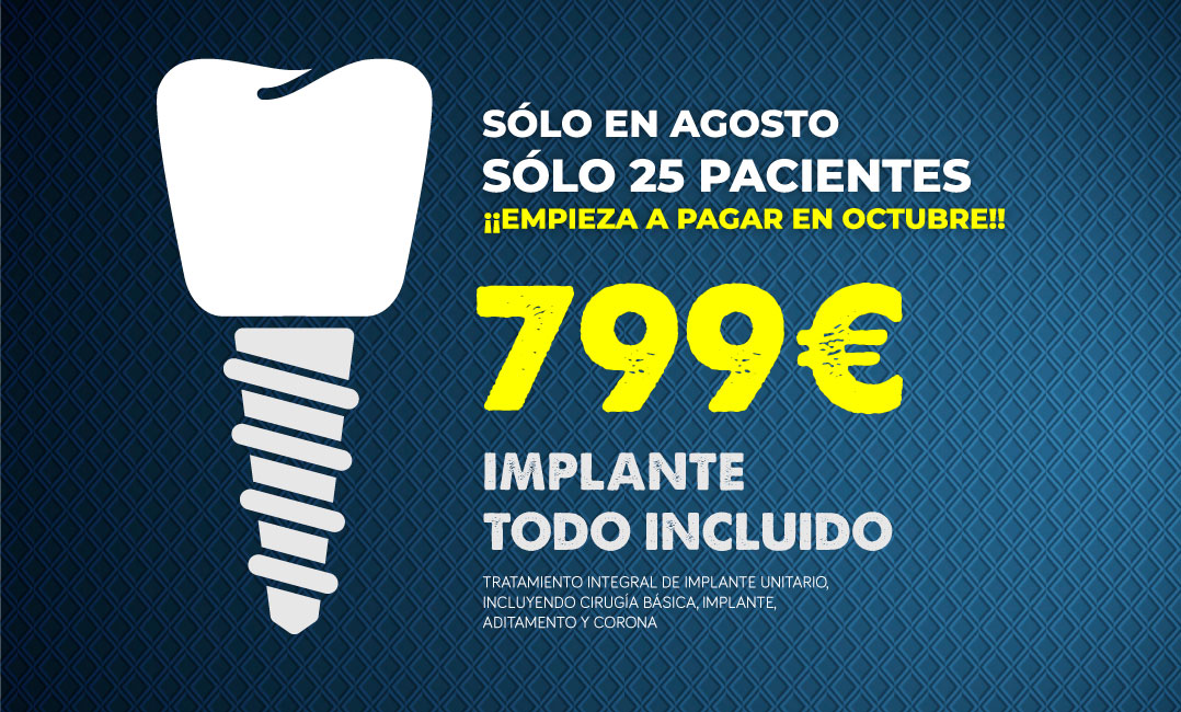 Oferta en Implantes Dentales Marbella y San Pedro Alcántara